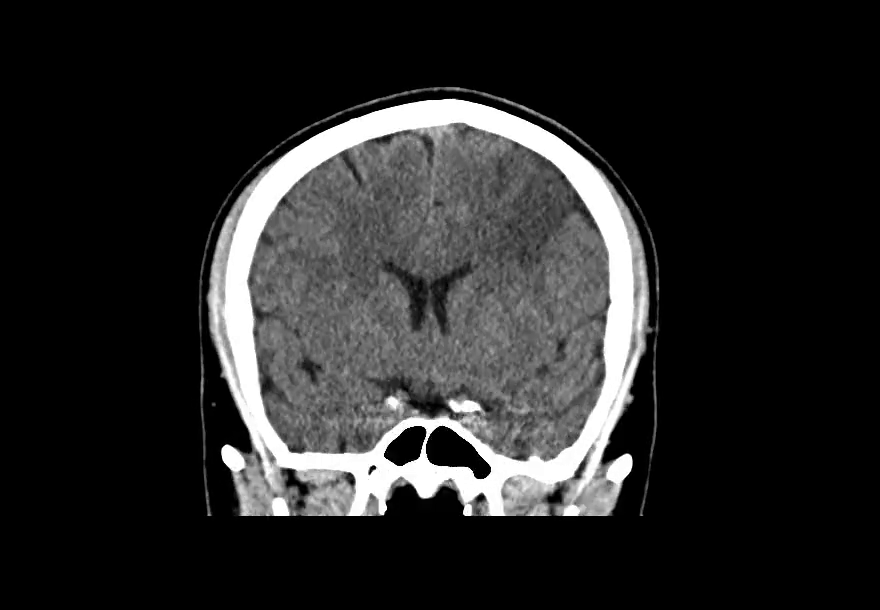 part II - the middle