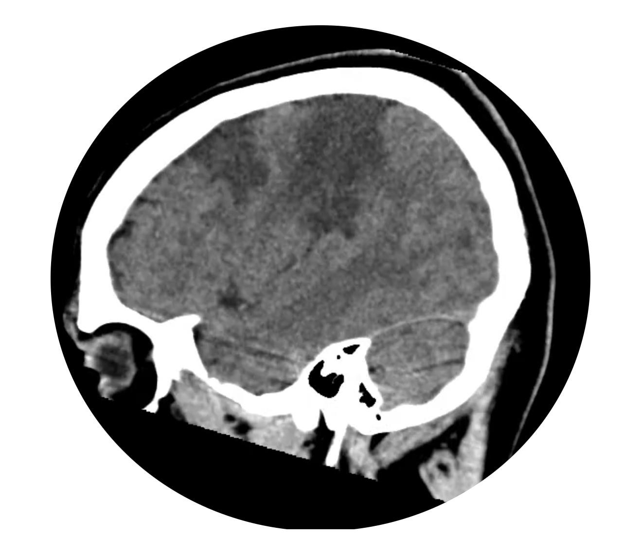 part III - my mistake, it wasn't the middle after all
