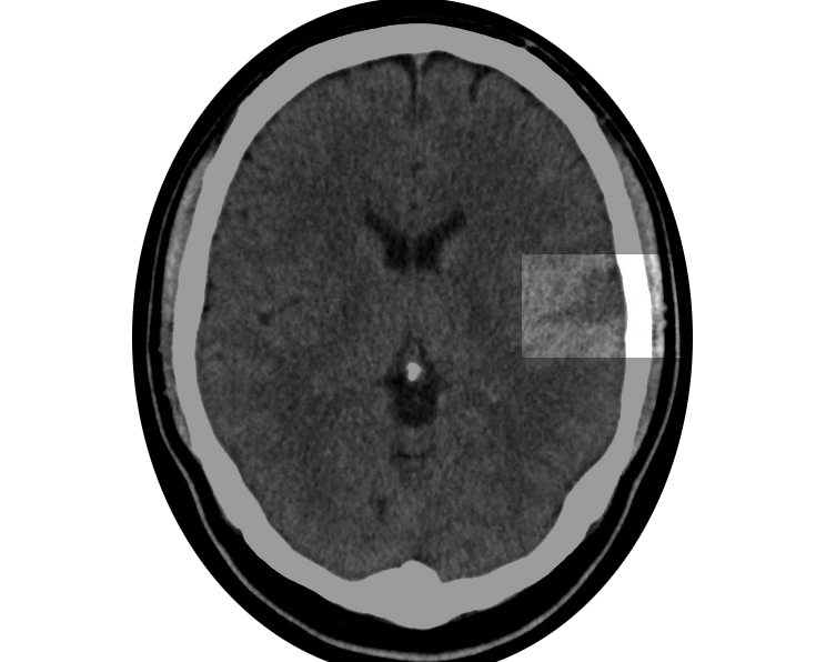 part  I - the beginning